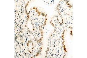 Immunohistochemical analysis of HMGB1 staining in human kidney formalin fixed paraffin embedded tissue section. (HMGB1 抗体  (N-Term))