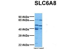 Host:  Rabbit  Target Name:  SLC6A8  Sample Tissue:  Human MDA-MB-435s, Human THP-1  Antibody Dilution:  1. (SLC6A8 抗体  (N-Term))