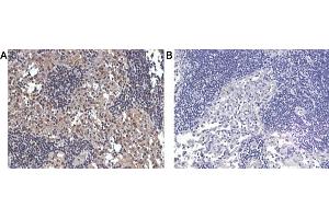 Immunohistochemical staining of human lymphnode tissue using A) anti-IL-33 (human), pAb  and B) anti-rabbit IgG (negative control) . (IL-33 抗体)