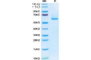 Human EFEMP1 on Tris-Bis PAGE under reduced condition. (FBLN3 Protein (AA 18-493) (His tag))