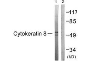 Western blot analysis of extracts from 293 cells, treated with EGF 200ng/ml 30', using Keratin 8 (Ab-431) Antibody. (KRT8 抗体  (AA 401-450))