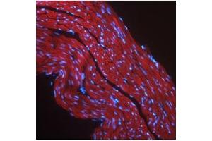 Immunofluorescent IGF1R detection in mouse skeletal muscle (red fluorescence). (IGF1R 抗体  (Middle Region))