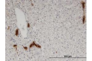 Immunoperoxidase of monoclonal antibody to CAPN9 on formalin-fixed paraffin-embedded human liver. (Calpain 9 抗体  (AA 591-690))
