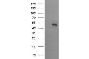 Image no. 3 for anti-serine/threonine Kinase 38 Like (STK38L) (AA 1-281) antibody (ABIN1490700) (STK38L 抗体  (AA 1-281))