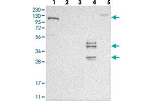 Western blot analysis of Lane 1: RT-4, Lane 2: U-251 MG, Lane 3: Human Plasma, Lane 4: Liver, Lane 5: Tonsil with ESPN polyclonal antibody . (Espin 抗体)