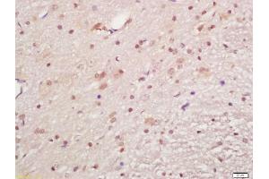 Formalin-fixed and paraffin embedded rat brain labeled with Anti-phospho-MAPKAPK5(Ser93)Polyclonal Antibody, Unconjugated (ABIN710561) at 1:200, followed by conjugation to the secondary antibody and DAB staining (MAPKAP Kinase 5 抗体  (pSer93))