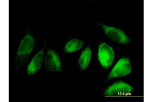 Immunofluorescence of purified MaxPab antibody to ALDH3A2 on HeLa cell. (ALDH3A2 抗体  (AA 1-508))