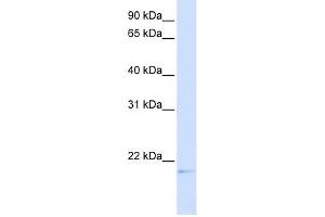 C14ORF180 antibody used at 1 ug/ml to detect target protein. (C14orf180 抗体  (Middle Region))