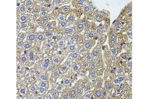 Immunohistochemistry of paraffin-embedded Mouse liver using CETP Polyclonal Antibody (CETP 抗体)