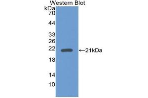 Western blot analysis of the recombinant protein. (GDF2 抗体  (AA 241-418))
