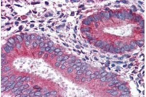 Human Uterus: Formalin-Fixed, Paraffin-Embedded (FFPE) (Calnexin 抗体  (AA 204-218))