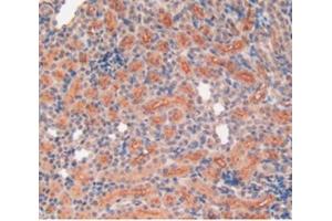 Detection of MMP12 in Rat Kidney Tissue using Polyclonal Antibody to Matrix Metalloproteinase 12 (MMP12) (MMP12 抗体  (AA 20-99))