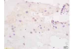 Formalin-fixed and paraffin embedded human placenta labeled with Anti SLC40A1/FPN1 Polyclonal Antibody, Unconjugated (ABIN1387819) at 1:200 followed by conjugation to the secondary antibody and DAB staining (SLC40A1 抗体  (AA 331-430))