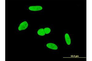 Immunofluorescence of monoclonal antibody to INTS6 on HeLa cell. (INTS6 抗体  (AA 779-887))