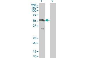 Western Blot analysis of MAP2K7 expression in transfected 293T cell line by MAP2K7 monoclonal antibody (M07), clone 2C12. (MAP2K7 抗体  (AA 1-99))