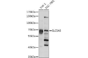 Western blot analysis of extracts of various cell lines, using SLC5 pAb (ABIN6127280, ABIN6148023, ABIN6148024 and ABIN6225047) at 1:1000 dilution. (SLC5A5 抗体  (AA 544-643))