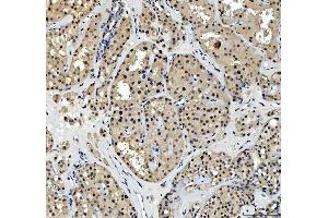 IHC analysis of TBX18 using anti-TBX18 antibody (ABIN7599494).