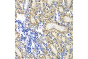 Immunohistochemistry of paraffin-embedded rat kidney using PTGES2 antibody (ABIN5974292) at dilution of 1/100 (40x lens). (PTGES2 抗体)
