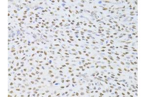 Immunohistochemistry of paraffin-embedded human adenomyosis using FKBP4 Antibody. (FKBP4 抗体  (AA 220-459))