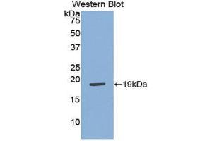 Western Blotting (WB) image for anti-Adrenomedullin (ADM) (AA 31-187) antibody (ABIN1172572) (Adrenomedullin 抗体  (AA 31-187))