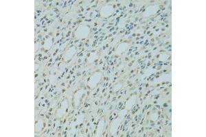 Immunohistochemistry (Paraffin-embedded Sections) (IHC (p)) image for anti-Scaffold Attachment Factor B (SAFB) (AA 1-200) antibody (ABIN6147357)