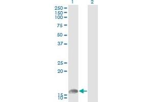 Western Blot analysis of UBE2L6 expression in transfected 293T cell line by UBE2L6 monoclonal antibody (M01), clone 2F12-1F4. (UBE2L6 抗体  (AA 1-153))