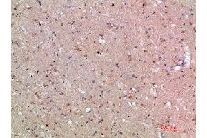 Immunohistochemical analysis of paraffin-embedded human-brain, antibody was diluted at 1:200 (ASCL1 抗体  (AA 190-236))