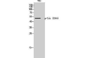 Western Blotting (WB) image for anti-C-Src tyrosine Kinase (CSK) (pSer364) antibody (ABIN3172998) (CSK 抗体  (pSer364))