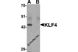 Western Blotting (WB) image for anti-Kruppel-Like Factor 4 (Gut) (KLF4) antibody (ABIN1031710) (KLF4 抗体)