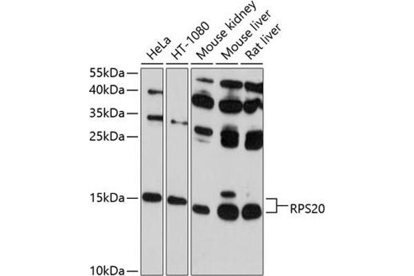 RPS20 抗体  (AA 1-119)