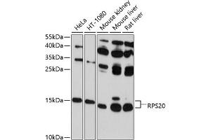 Western blot analysis of extracts of various cell lines, using RPS20 antibody (ABIN6129112, ABIN6147211, ABIN6147212 and ABIN6214592) at 1:1000 dilution. (RPS20 抗体  (AA 1-119))