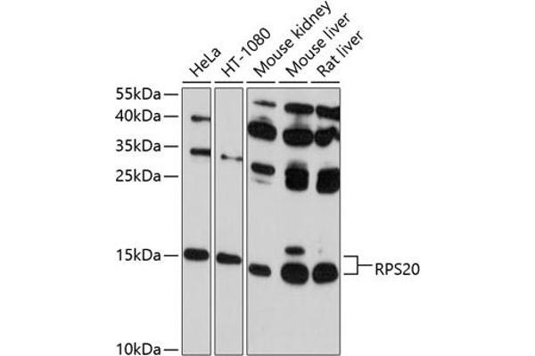 RPS20 antibody  (AA 1-119)