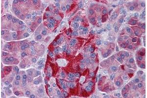 Human Pancreas: Formalin-Fixed, Paraffin-Embedded (FFPE) (EPHX4 抗体  (AA 71-120))