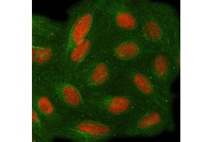 IF analysis of TOE1 using anti-TOE1 antibody (ABIN7601080) and anti-Tubulin Alpha antibody (ABIN7600339).