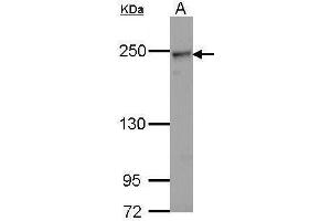 WB Image Sample (30 ug of whole cell lysate) A: Hela 5% SDS PAGE antibody diluted at 1:1000 (COL4a2 抗体)