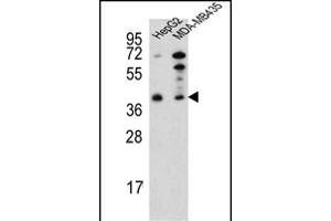 Western blot analysis of RP16 Antibody (C-term) (ABIN652189 and ABIN2840724) in HepG2,MDA-M cell line lysates (35 μg/lane). (PARP16 抗体  (C-Term))