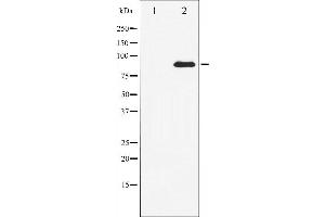 Western blot analysis of STAT3 expression in HeLa whole cell lysates,The lane on the left is treated with the antigen-specific peptide. (STAT3 抗体  (C-Term))