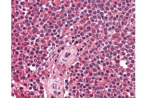 Anti-CXCR5 antibody IHC of human spleen. (CXCR5 抗体)