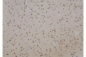 ABIN6274700 at 1/100 staining Human brain tissue by IHC-P. (RAD51 Homolog B 抗体)