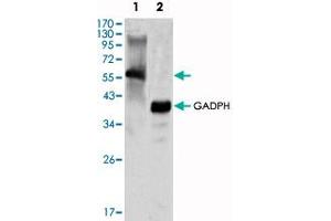 Western blot analysis using MATK monoclonal antibody, clone 9D7  against K-562 cell lysate. (MATK 抗体)