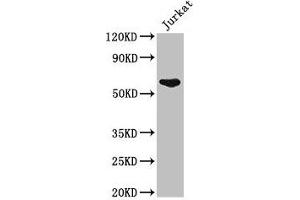 Western Blot Positive WB detected in: Jurkat whole cell lysate All lanes: UAP1 antibody at 2. (UAP1 抗体  (AA 1-522))
