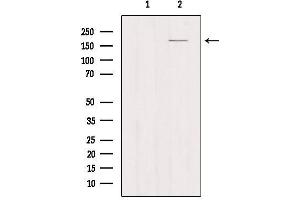 Western Blotting (WB) image for anti-Mannose Receptor, C Type 1 (MRC1) (Internal Region) antibody (ABIN6257039)