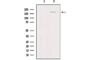 Western blot analysis of extracts from Myeloma cells, using MRC1 Antibody. (Macrophage Mannose Receptor 1 抗体  (Internal Region))