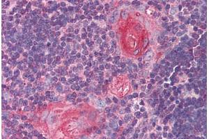 Human Thymus (formalin-fixed, paraffin-embedded) stained with SMC4 antibody ABIN290379 at 5 ug/ml followed by biotinylated goat anti-rabbit IgG secondary antibody ABIN481713, alkaline phosphatase-streptavidin and chromogen. (SMC4 抗体  (AA 281-297))