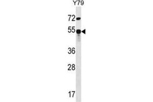 ZFP14 Antibody (N-term) western blot analysis in Y79 cell line lysates (35 µg/lane). (ZFP14 抗体  (N-Term))