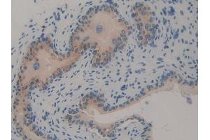 Detection of TRAF2 in Mouse Vas Deferens Tissue using Polyclonal Antibody to TNF Receptor Associated Factor 2 (TRAF2) (TRAF2 抗体  (AA 238-491))