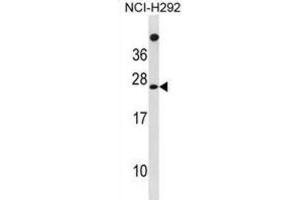 Western Blotting (WB) image for anti-Mannose-P-Dolichol Utilization Defect 1 (MPDU1) antibody (ABIN3001379) (MPDU1 抗体)