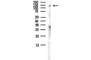 anti-Myb-Binding Protein 1A (MYBBP1A) (C-Term) antibody