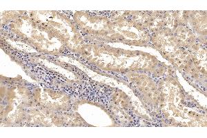 Detection of KPNa2 in Human Kidney Tissue using Monoclonal Antibody to Karyopherin Alpha 2 (KPNa2) (KPNA2 抗体  (AA 157-412))
