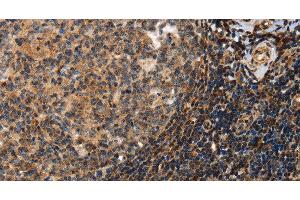 Immunohistochemistry of paraffin-embedded Human tonsil using PON1 Polyclonal Antibody at dilution of 1:40 (PON1 抗体)